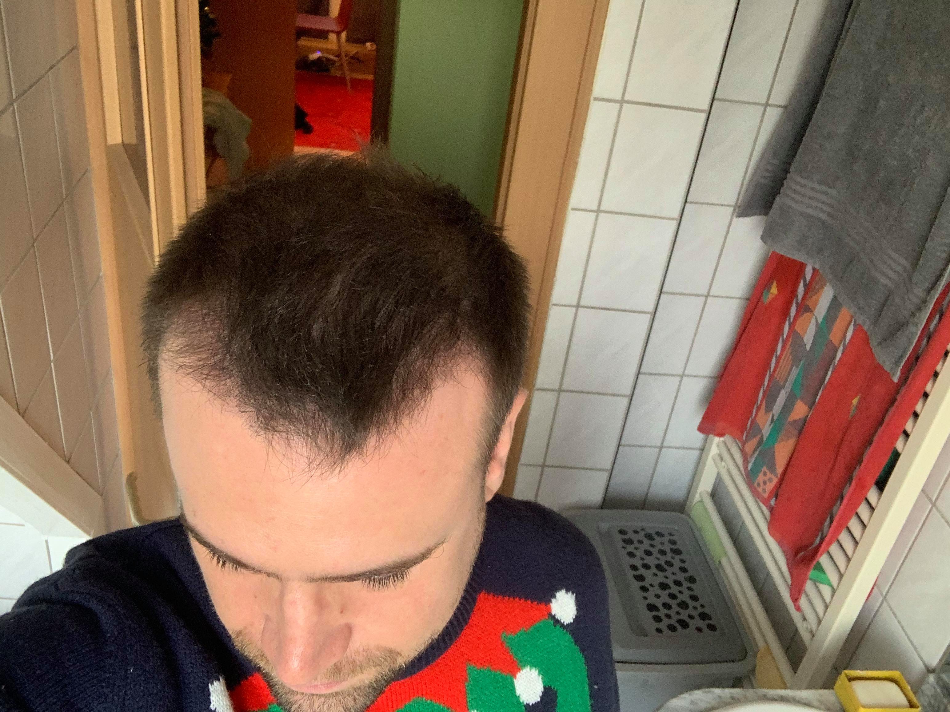 /foren/transplant/index.php/fa/49517/0/