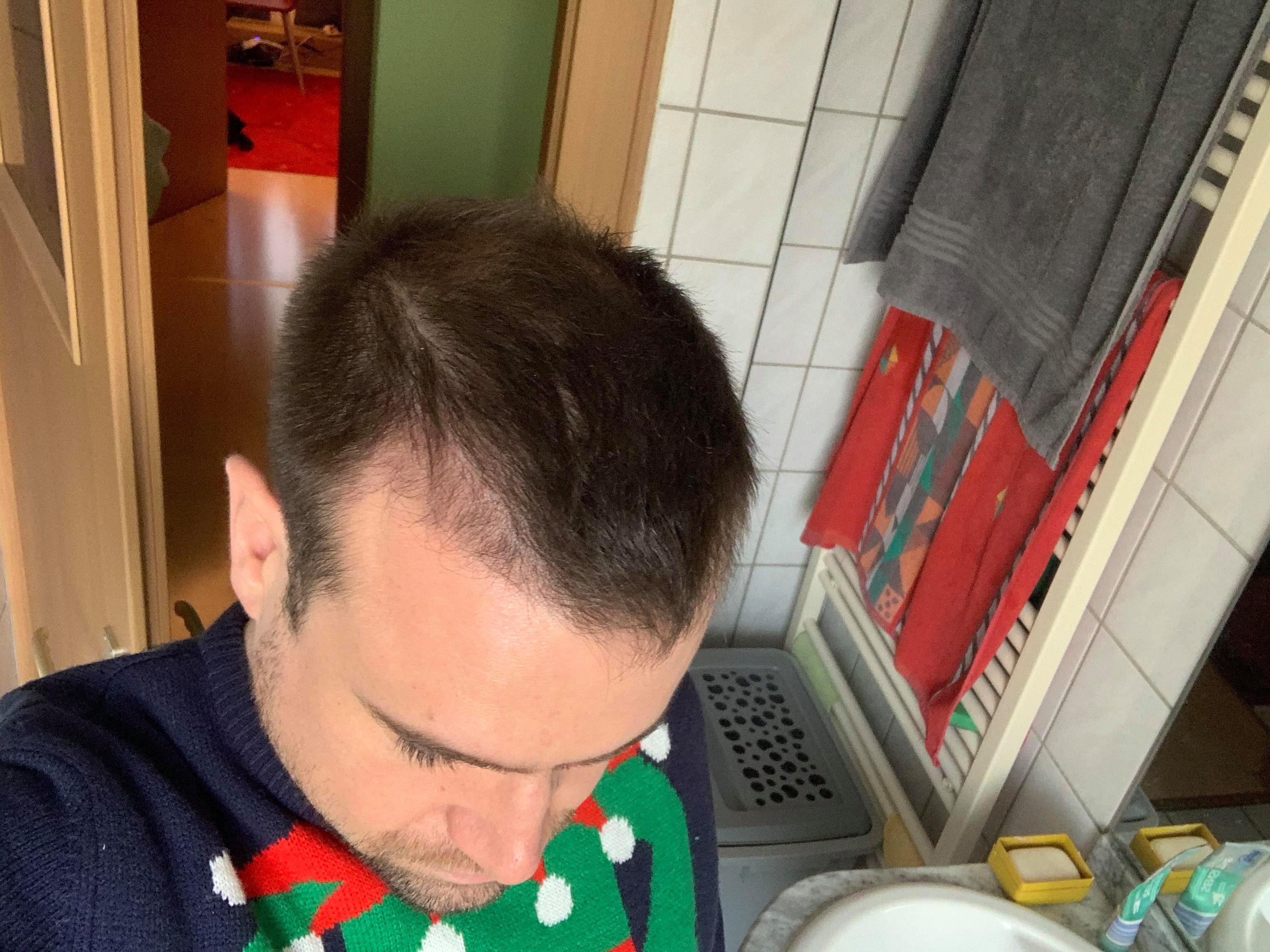 /foren/transplant/index.php/fa/49518/0/