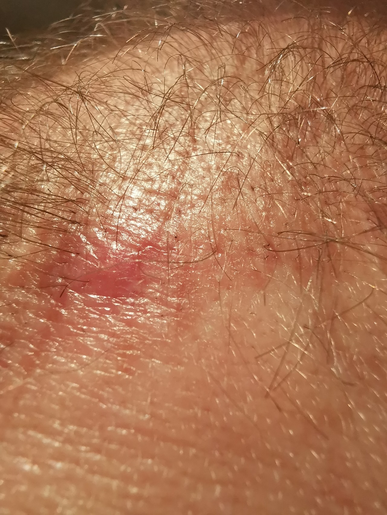 /foren/transplant/index.php/fa/49543/0/