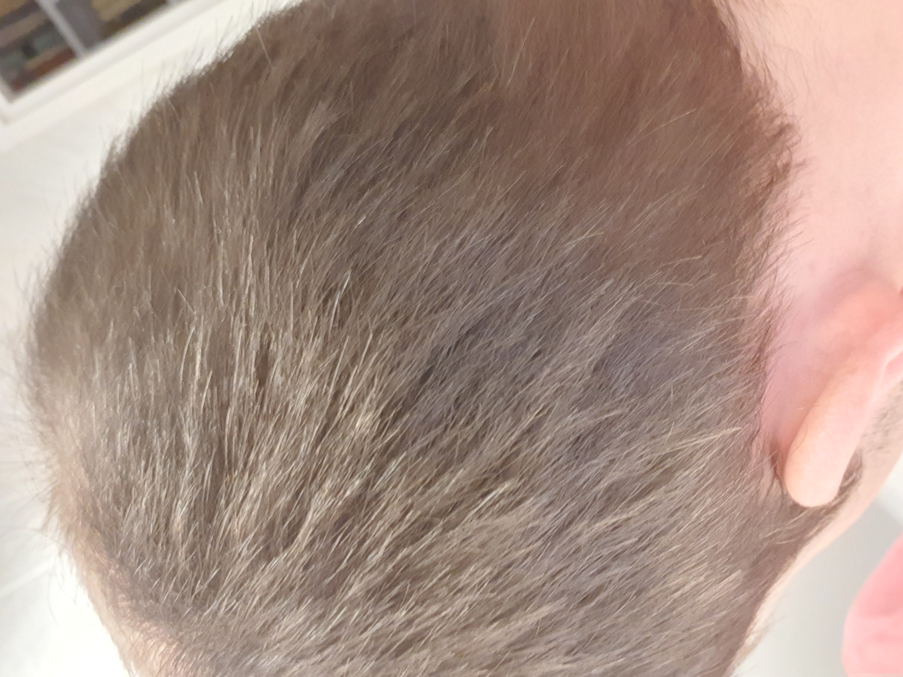 /foren/transplant/index.php/fa/49582/0/