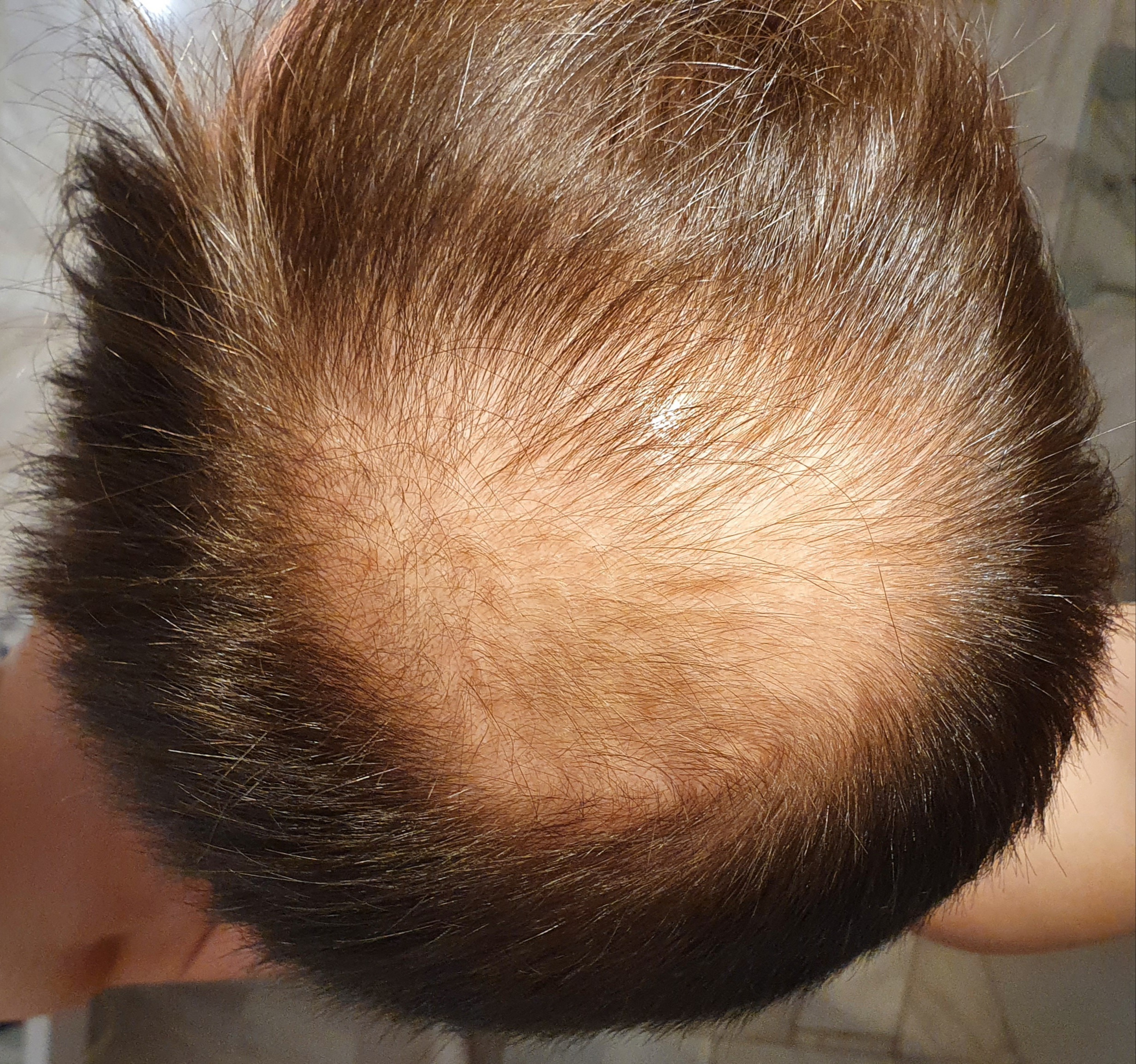 /foren/transplant/index.php/fa/49594/0/