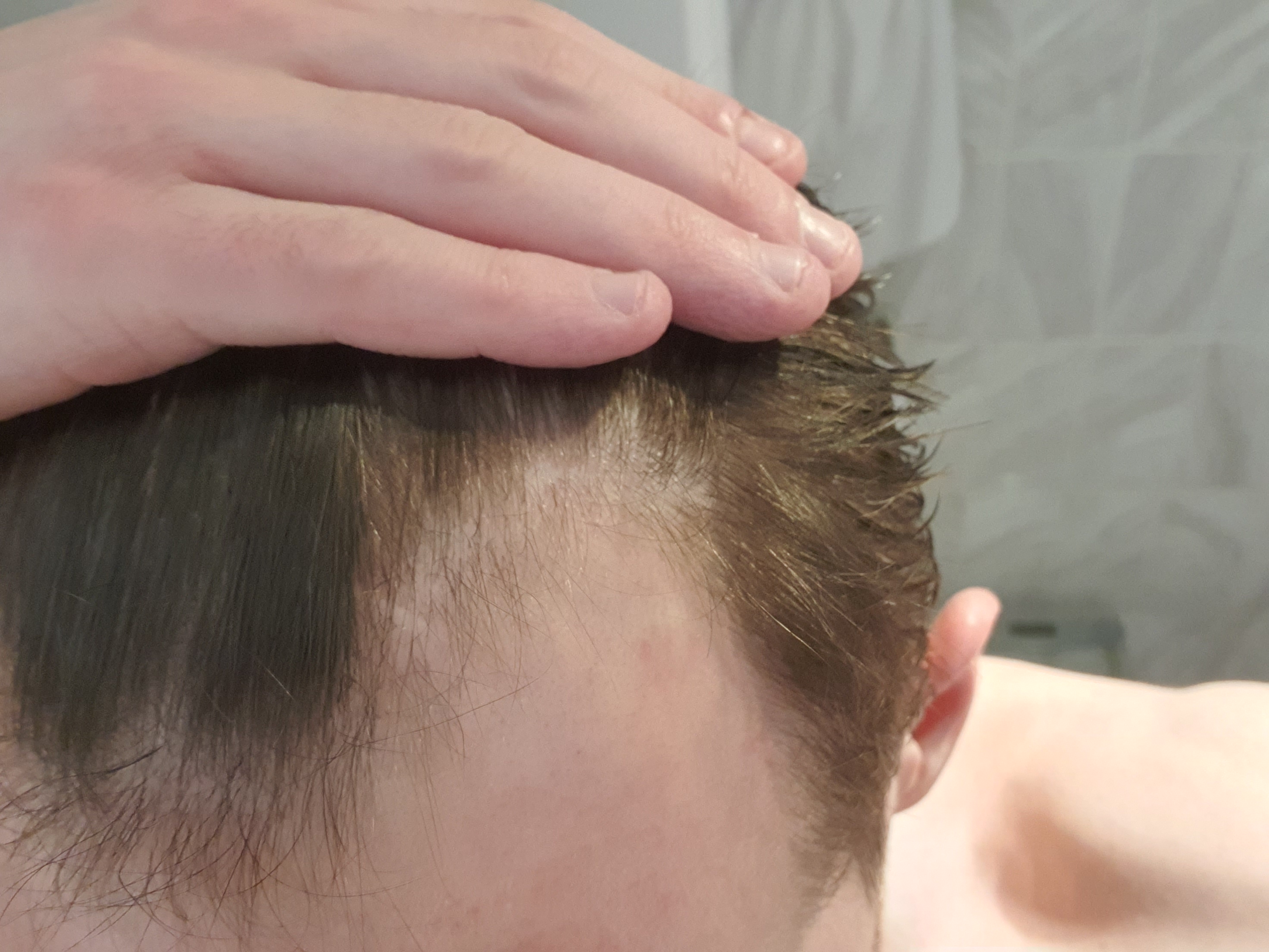 /foren/transplant/index.php/fa/49595/0/