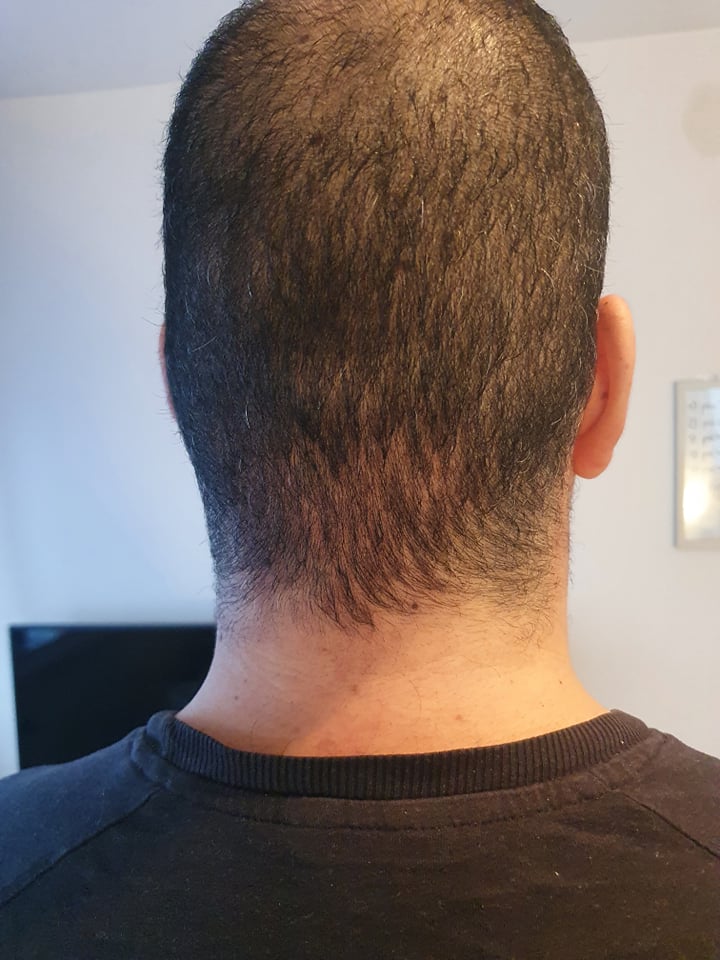 /foren/transplant/index.php/fa/49705/0/