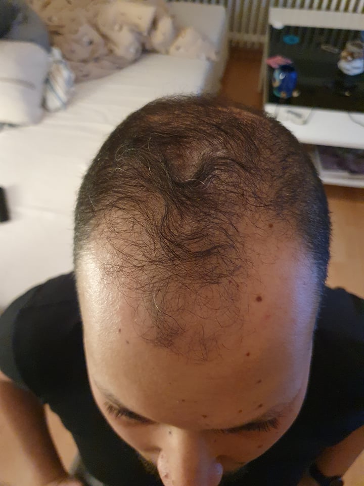 /foren/transplant/index.php/fa/49706/0/