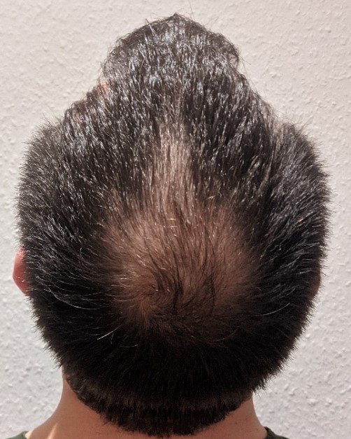 /foren/transplant/index.php/fa/49765/0/