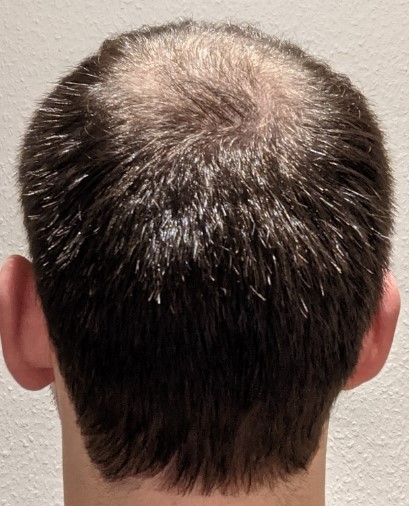 /foren/transplant/index.php/fa/49767/0/