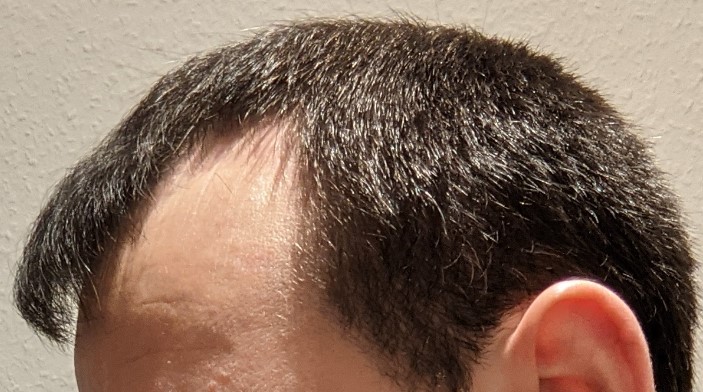 /foren/transplant/index.php/fa/49768/0/