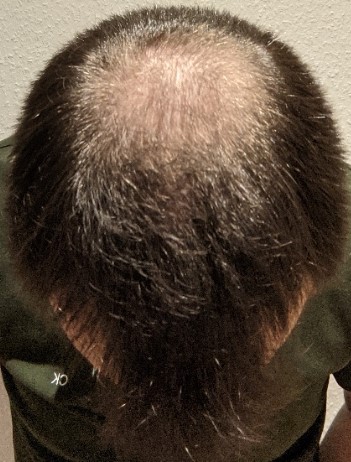 /foren/transplant/index.php/fa/49770/0/