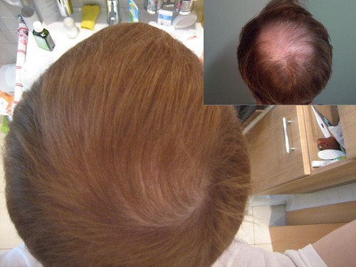 index.php/fa/4994/0/