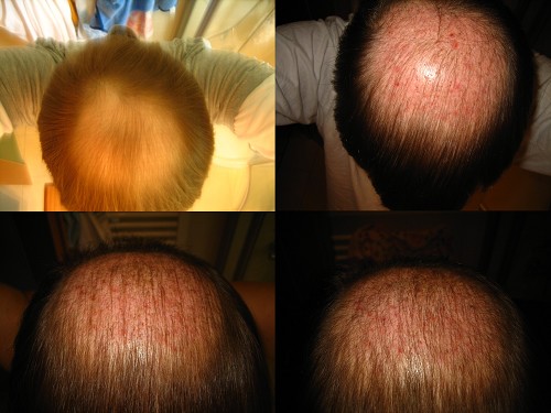 index.php/fa/4995/0/