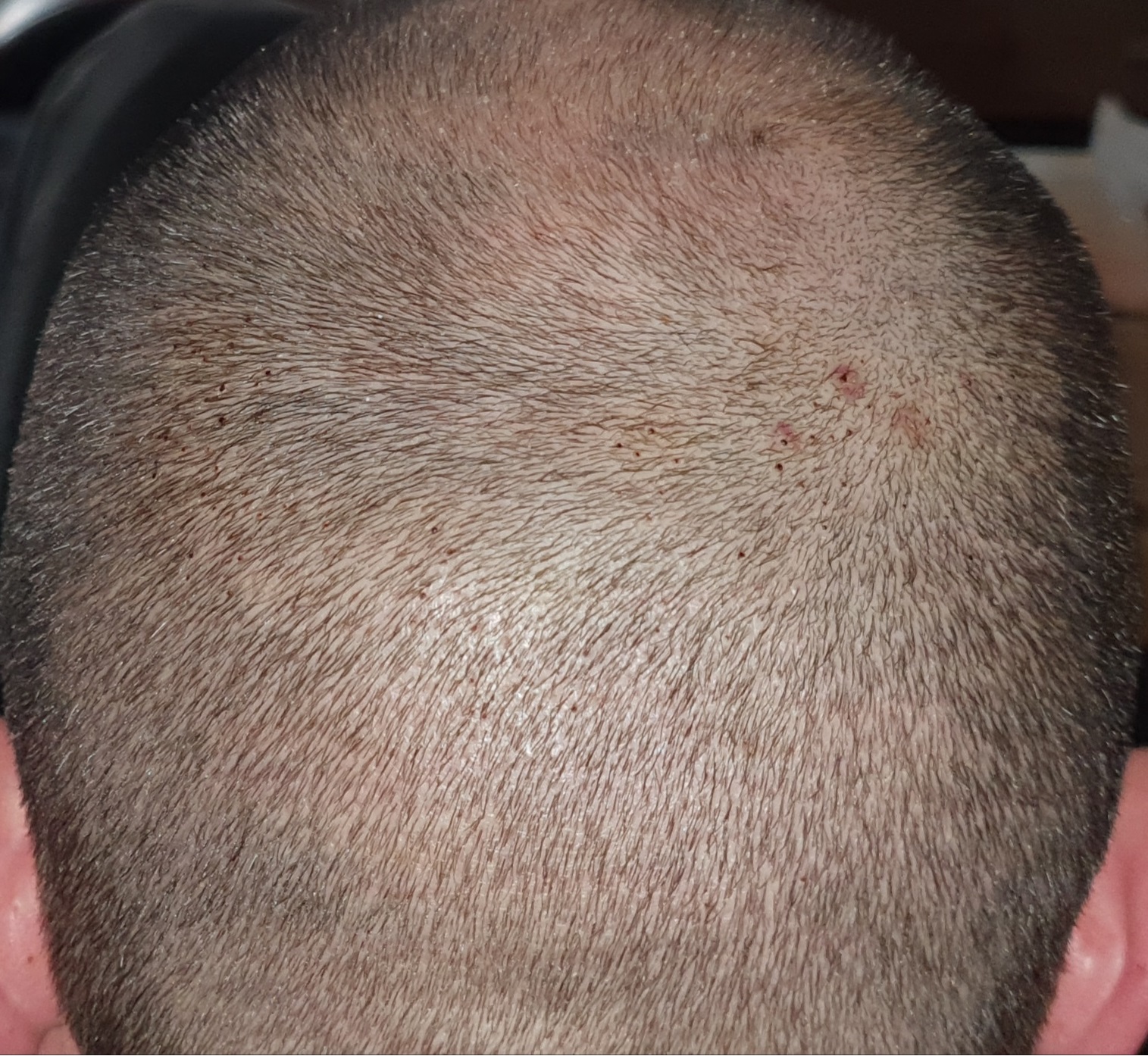 /foren/transplant/index.php/fa/49994/0/