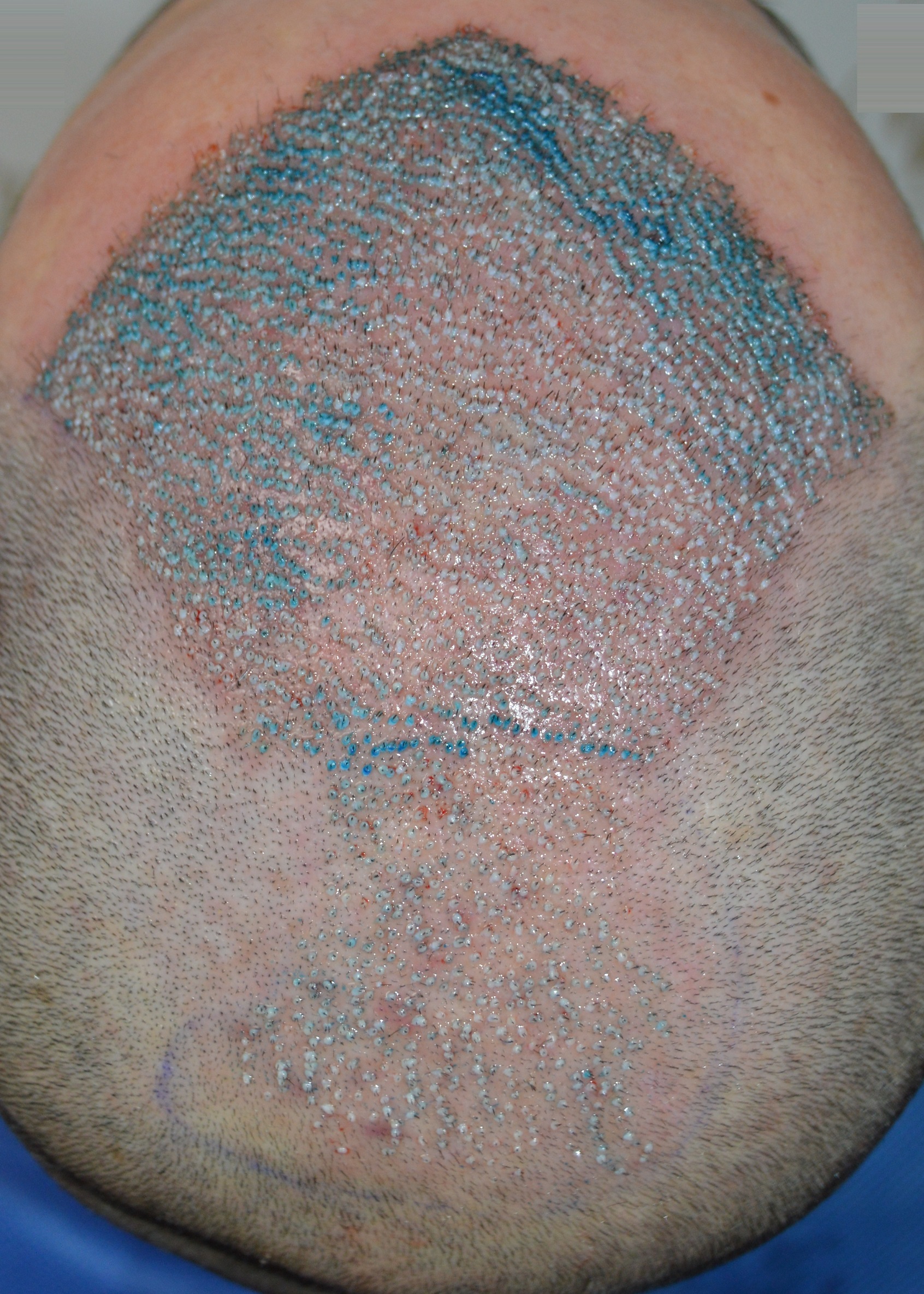 /foren/transplant/index.php/fa/49996/0/