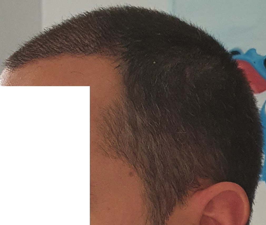 /foren/transplant/index.php/fa/49997/0/