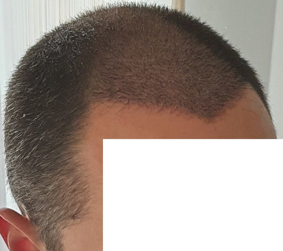 /foren/transplant/index.php/fa/49998/0/