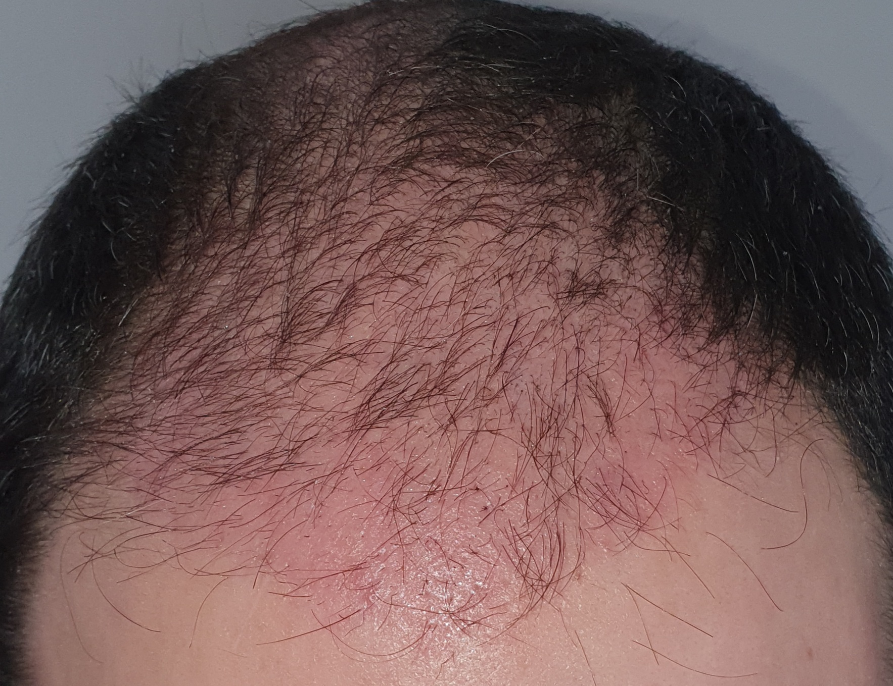 /foren/transplant/index.php/fa/50000/0/