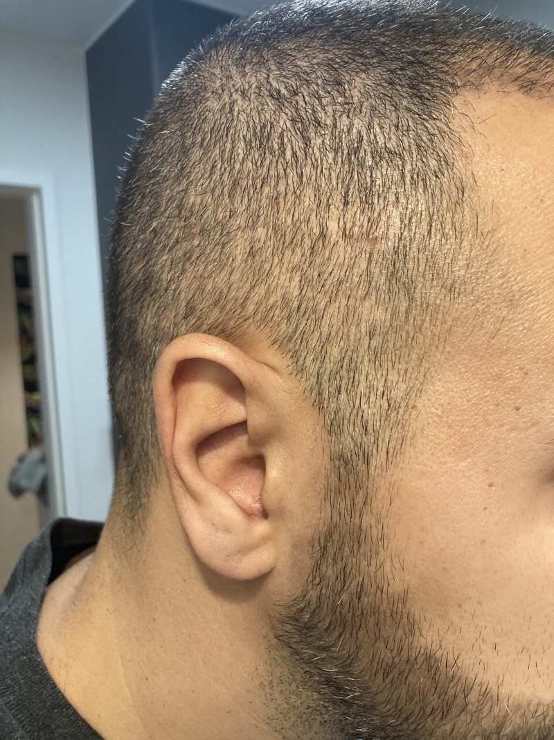 /foren/transplant/index.php/fa/50010/0/