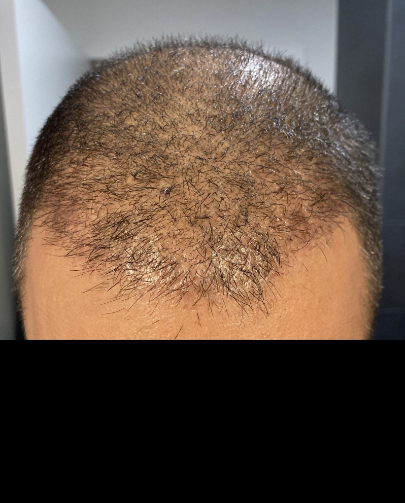 /foren/transplant/index.php/fa/50011/0/