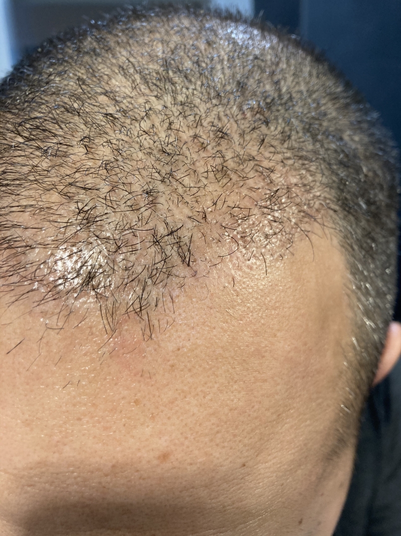 /foren/transplant/index.php/fa/50012/0/