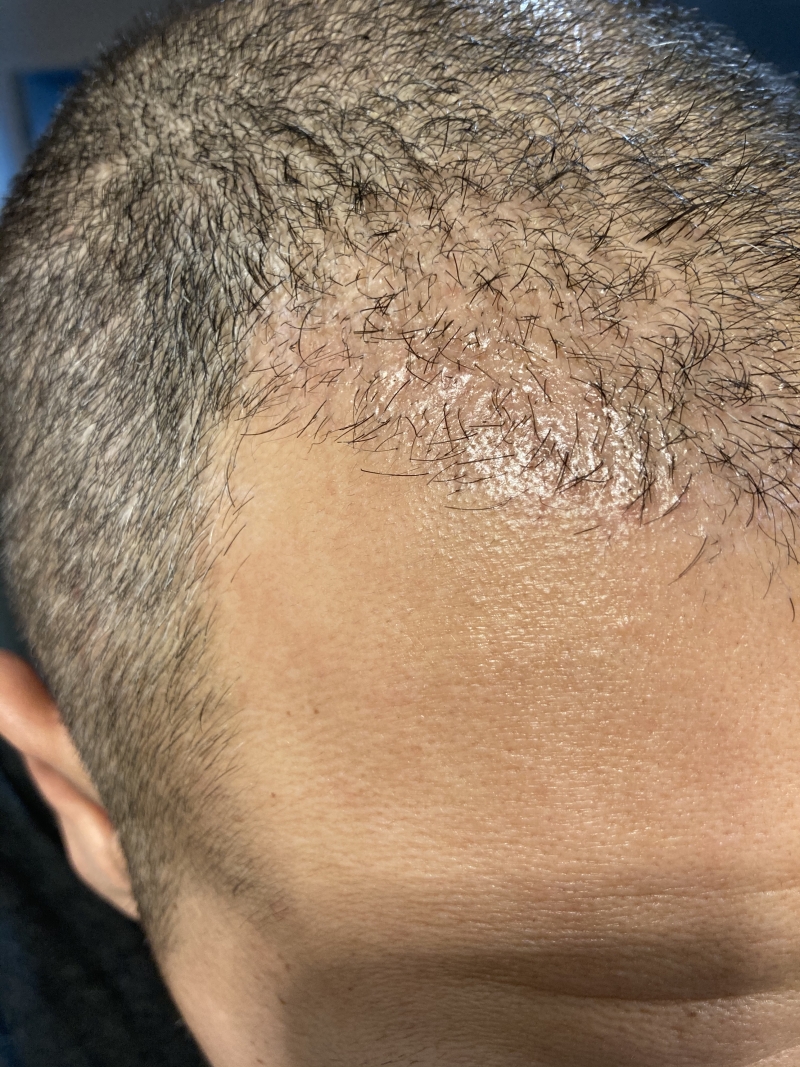 /foren/transplant/index.php/fa/50013/0/