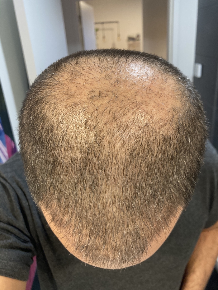 /foren/transplant/index.php/fa/50014/0/