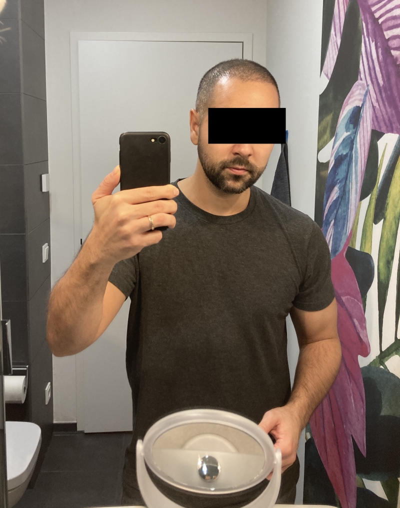 /foren/transplant/index.php/fa/50015/0/