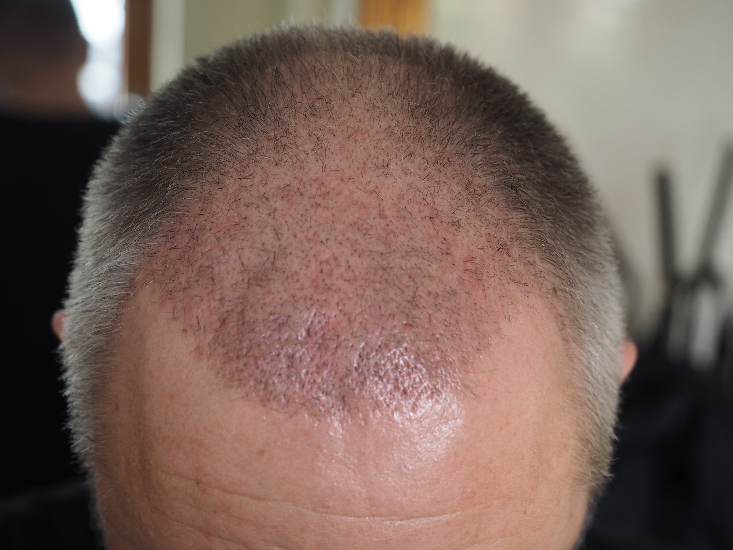 /foren/transplant/index.php/fa/50016/0/