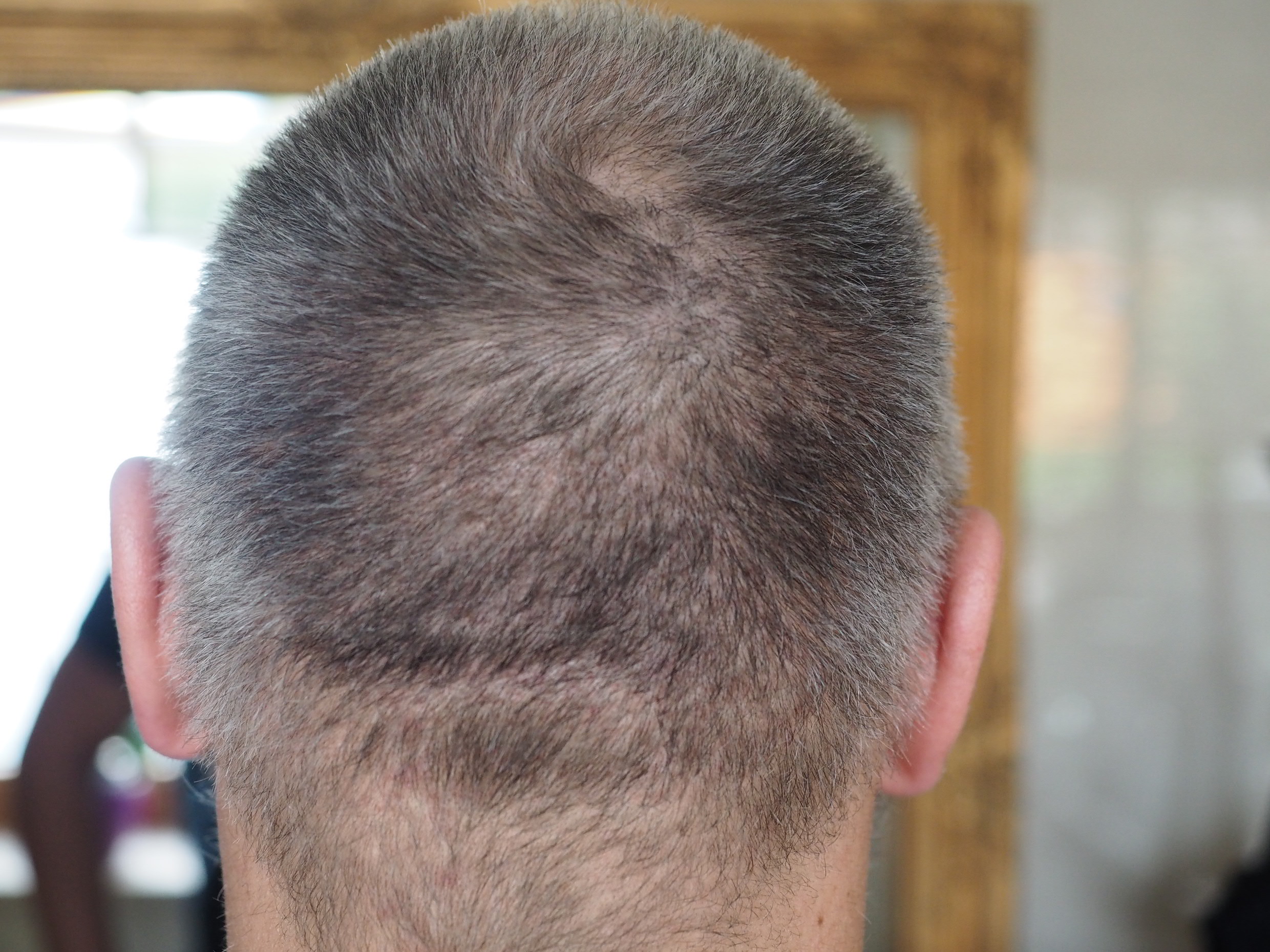 /foren/transplant/index.php/fa/50018/0/