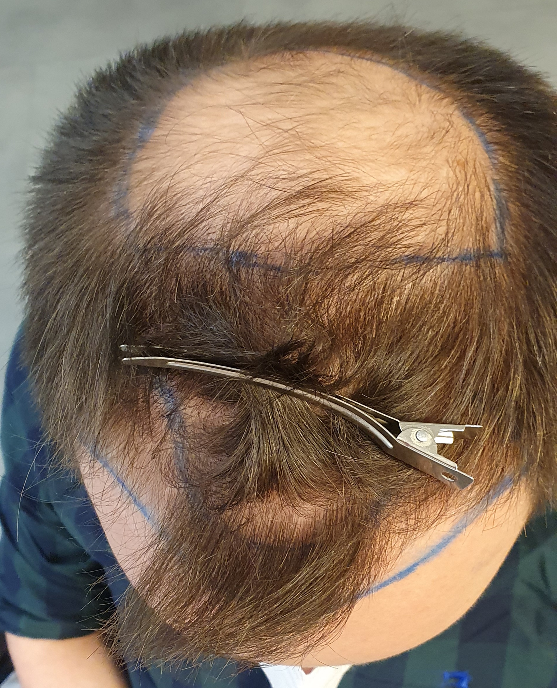 /foren/transplant/index.php/fa/50043/0/