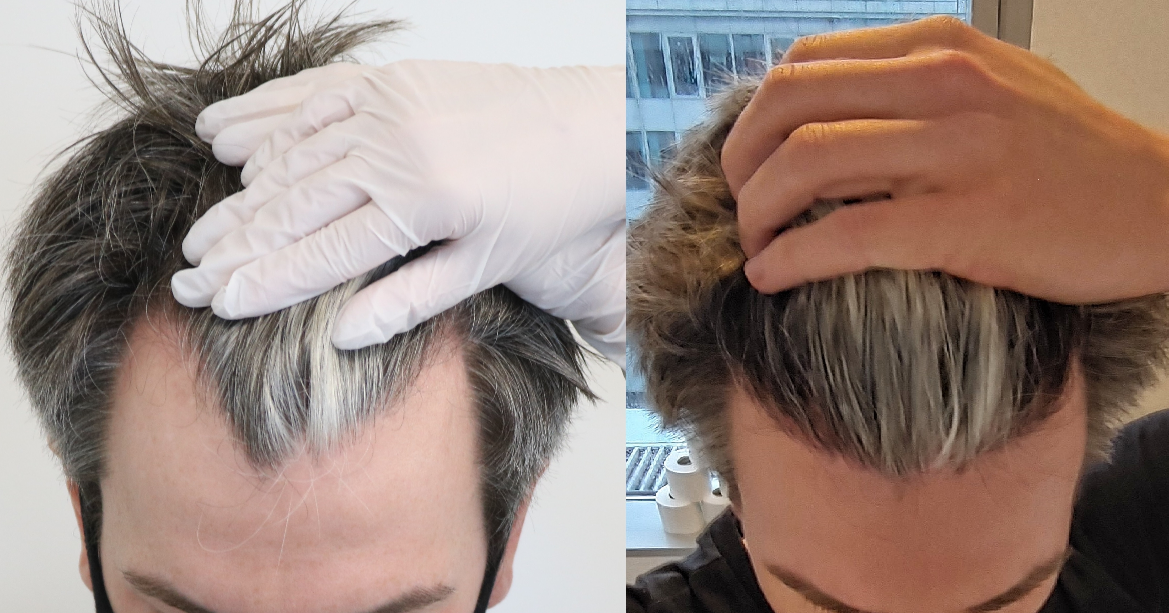 /foren/transplant/index.php/fa/50057/0/