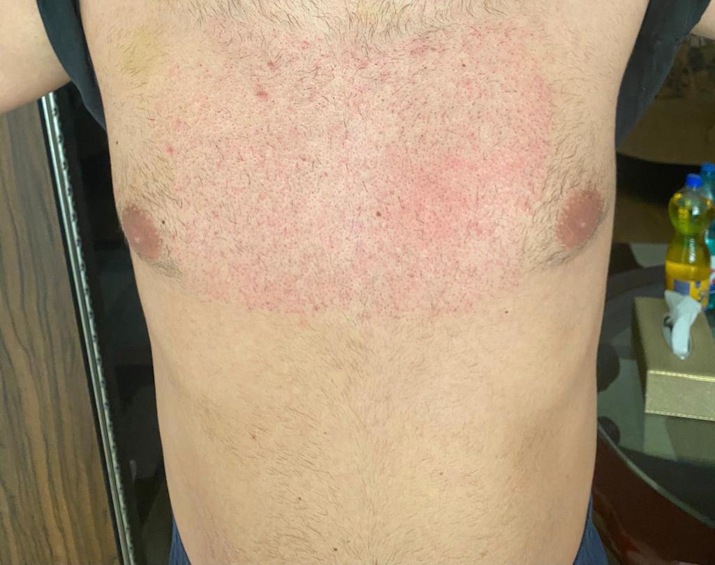 /foren/transplant/index.php/fa/50139/0/