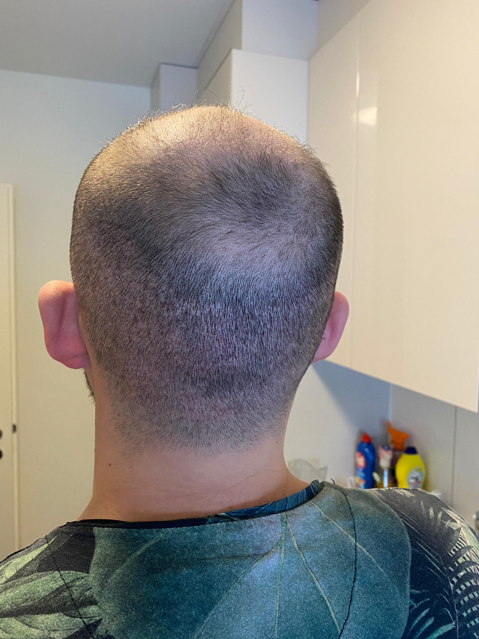 /foren/transplant/index.php/fa/50142/0/