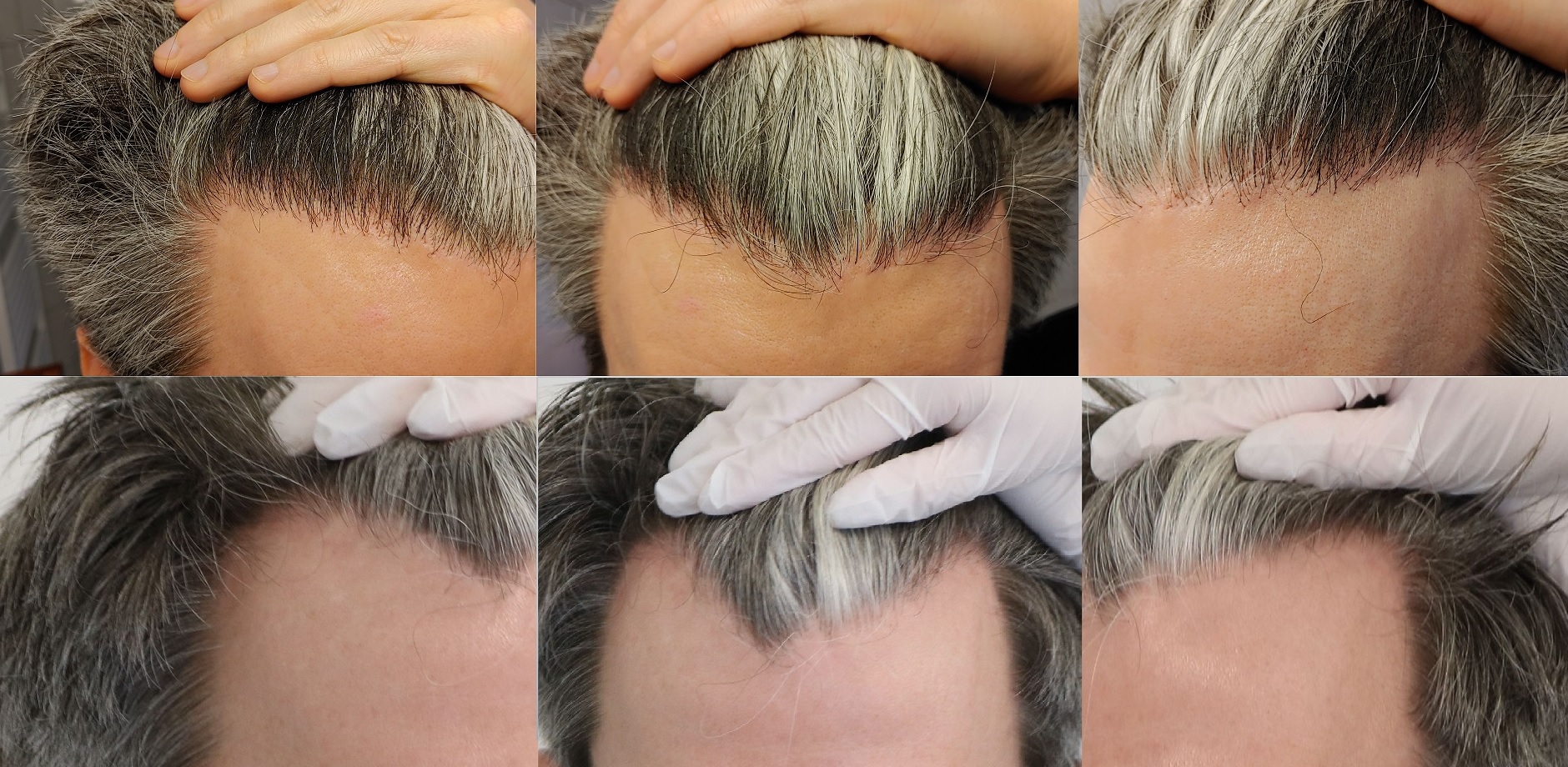 /foren/transplant/index.php/fa/50149/0/