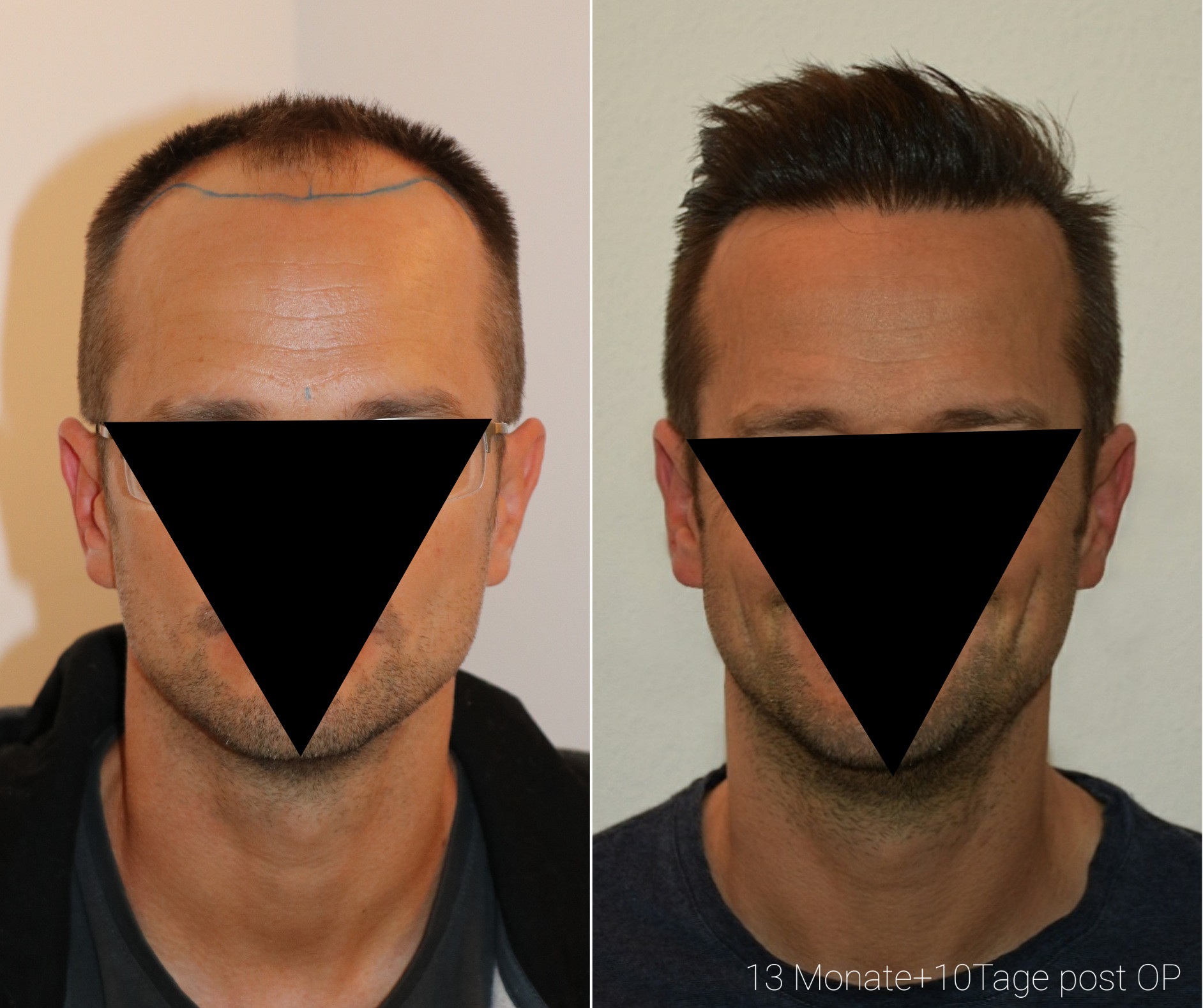 /foren/transplant/index.php/fa/50203/0/