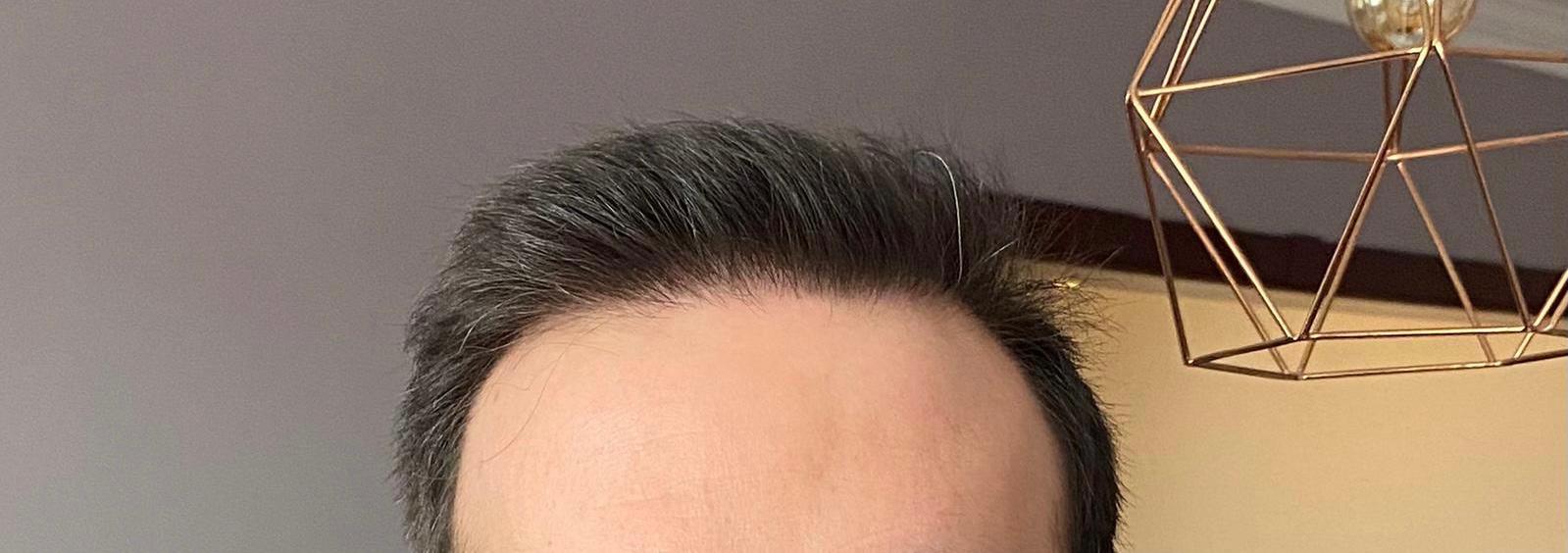 /foren/transplant/index.php/fa/50227/0/