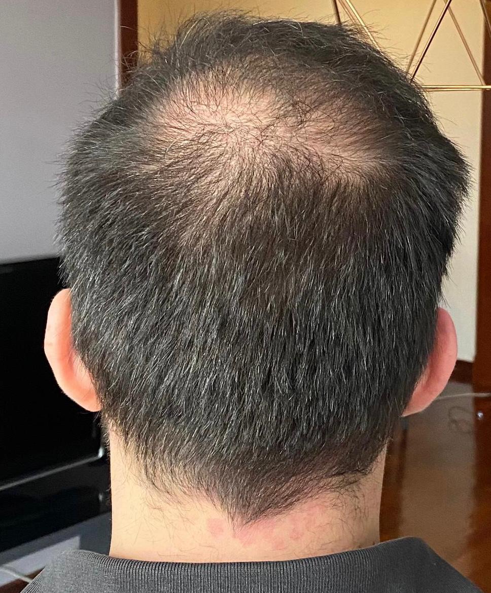 /foren/transplant/index.php/fa/50230/0/