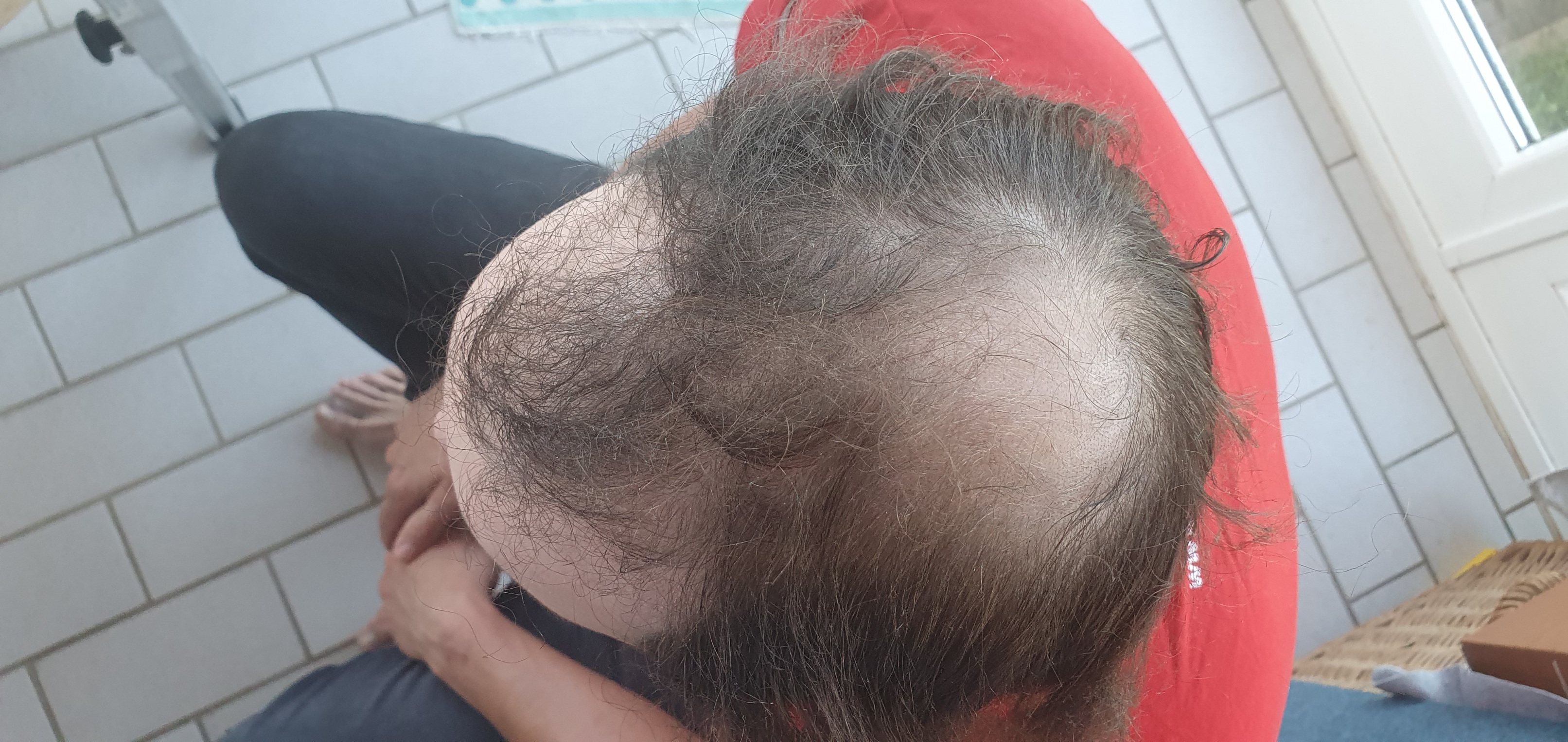 /foren/transplant/index.php/fa/50285/0/