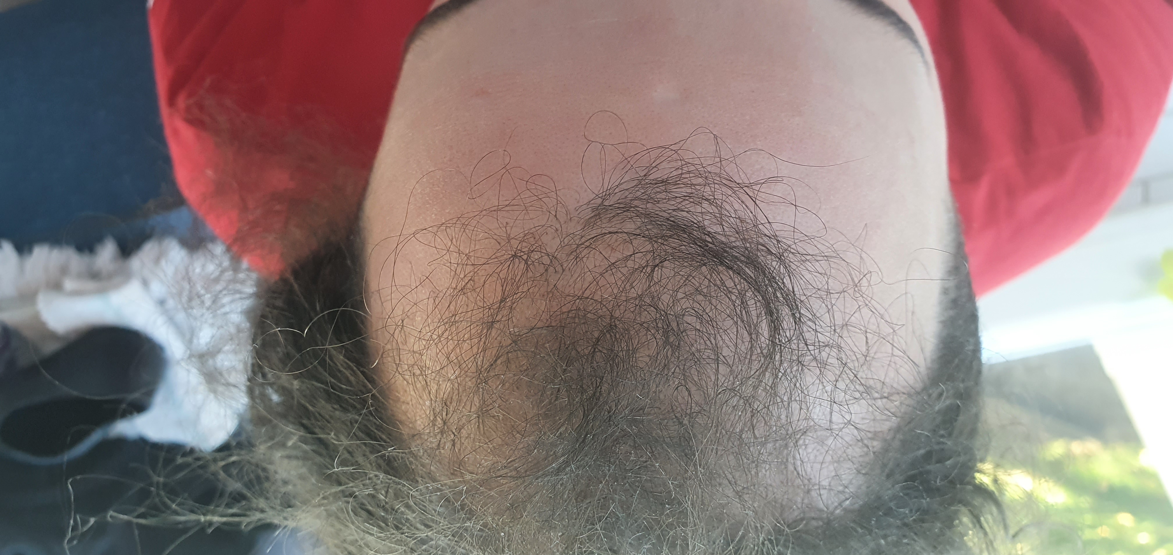 /foren/transplant/index.php/fa/50286/0/