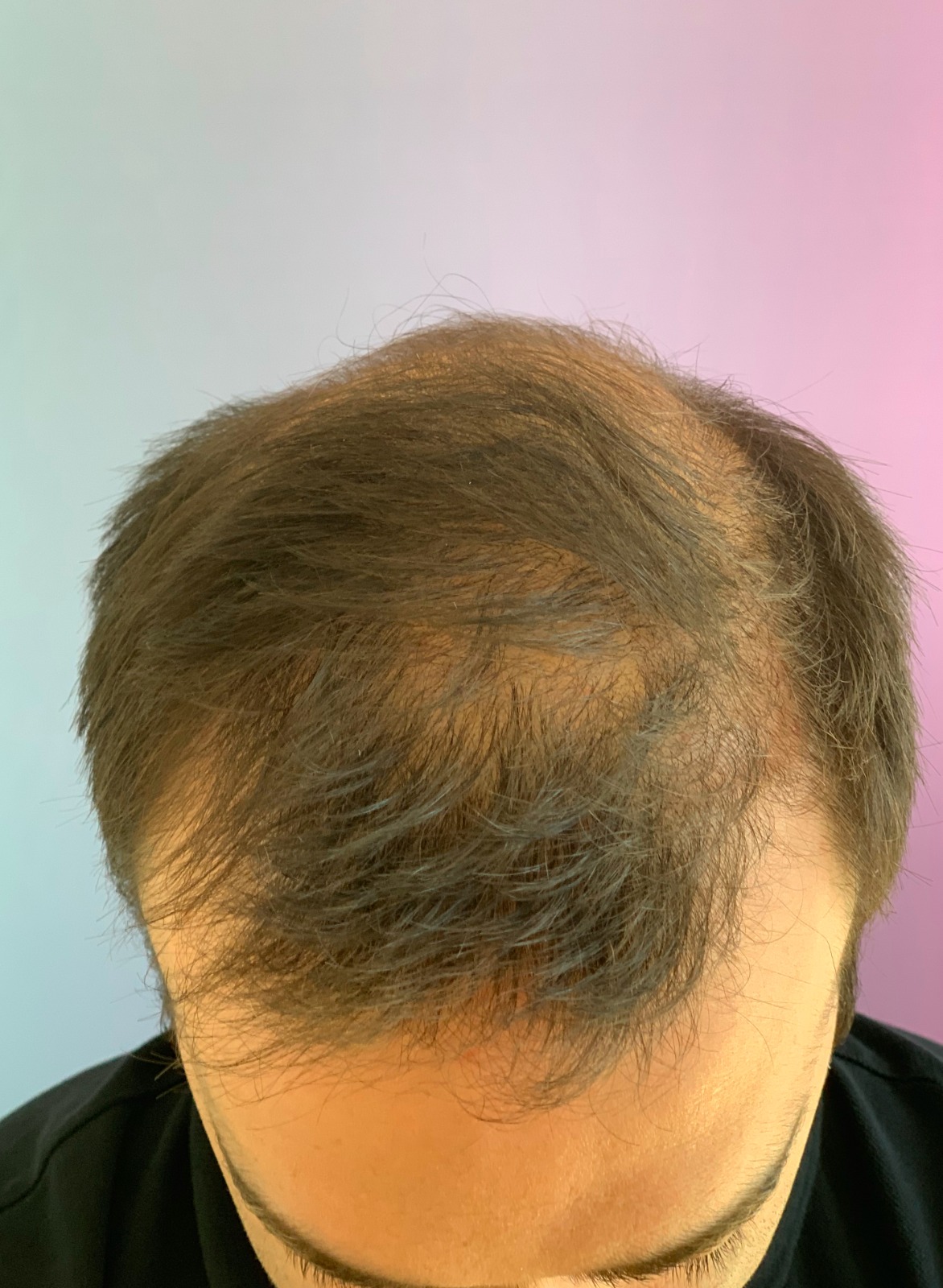 /foren/transplant/index.php/fa/50331/0/