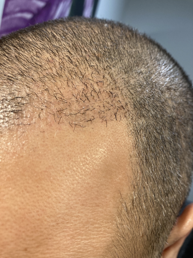 /foren/transplant/index.php/fa/50339/0/