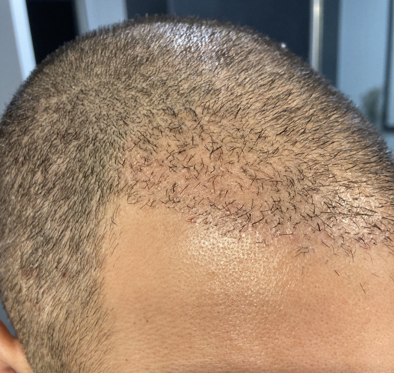 /foren/transplant/index.php/fa/50340/0/