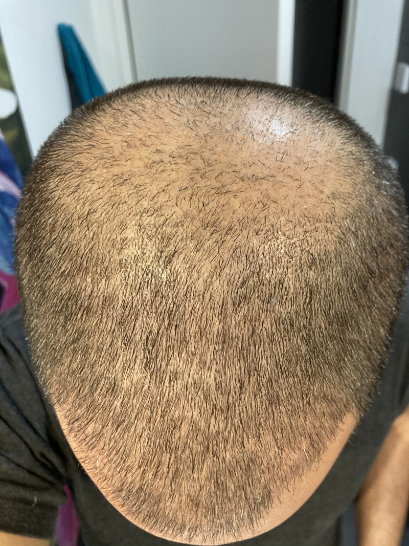 /foren/transplant/index.php/fa/50341/0/