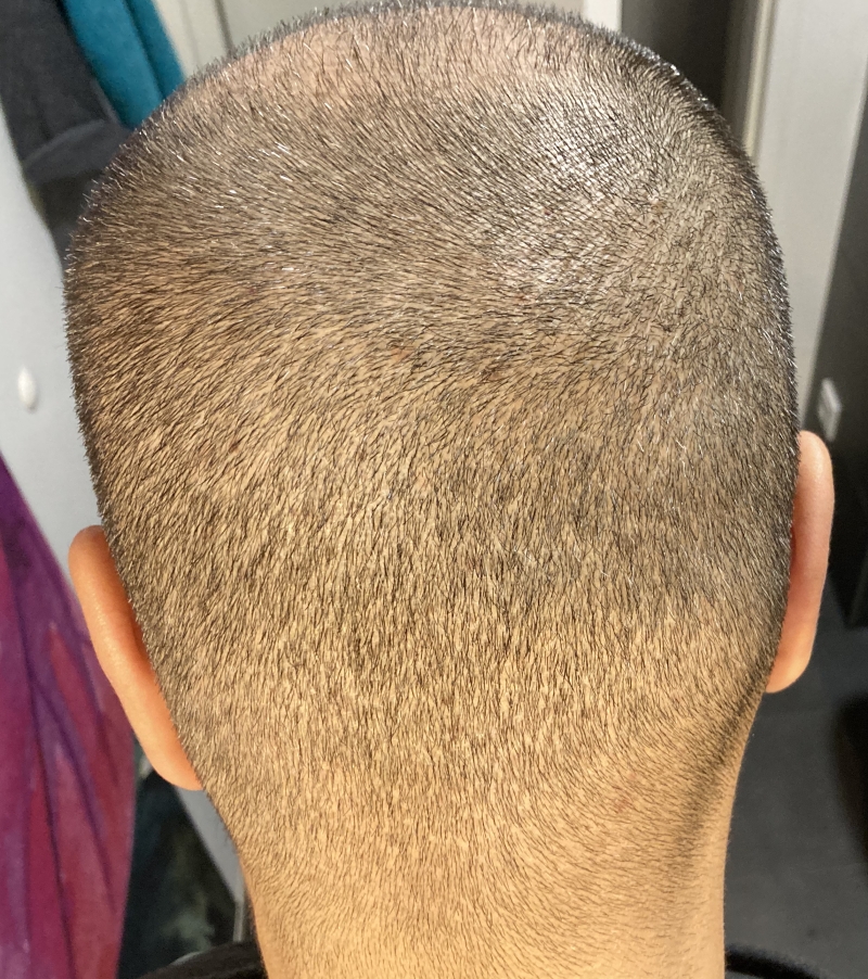 /foren/transplant/index.php/fa/50342/0/