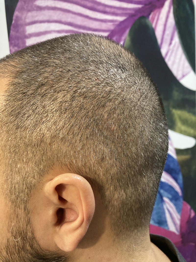 /foren/transplant/index.php/fa/50343/0/