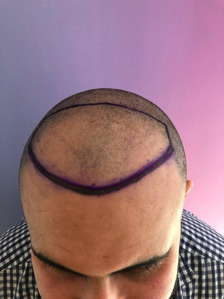 /foren/transplant/index.php/fa/50392/0/