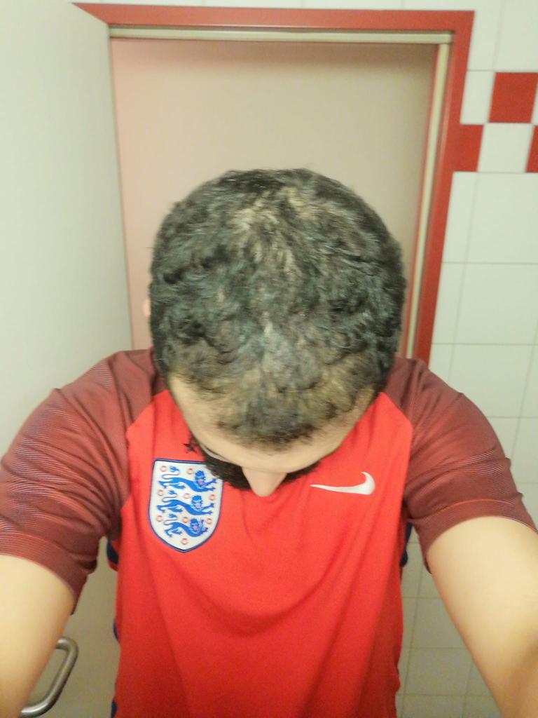 /foren/transplant/index.php/fa/50397/0/