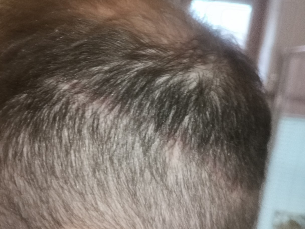 /foren/transplant/index.php/fa/50446/0/