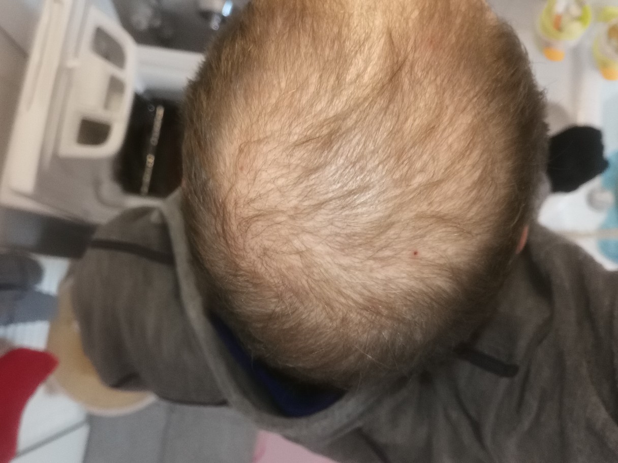 /foren/transplant/index.php/fa/50447/0/