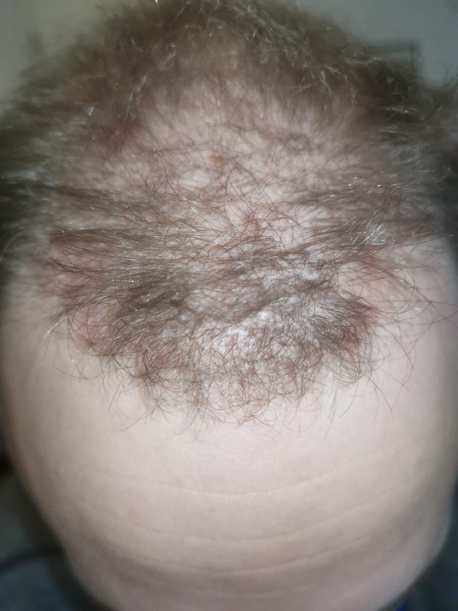 /foren/transplant/index.php/fa/50448/0/