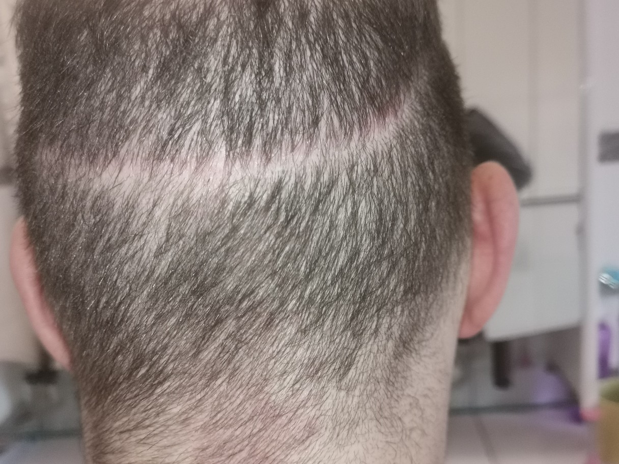 /foren/transplant/index.php/fa/50449/0/