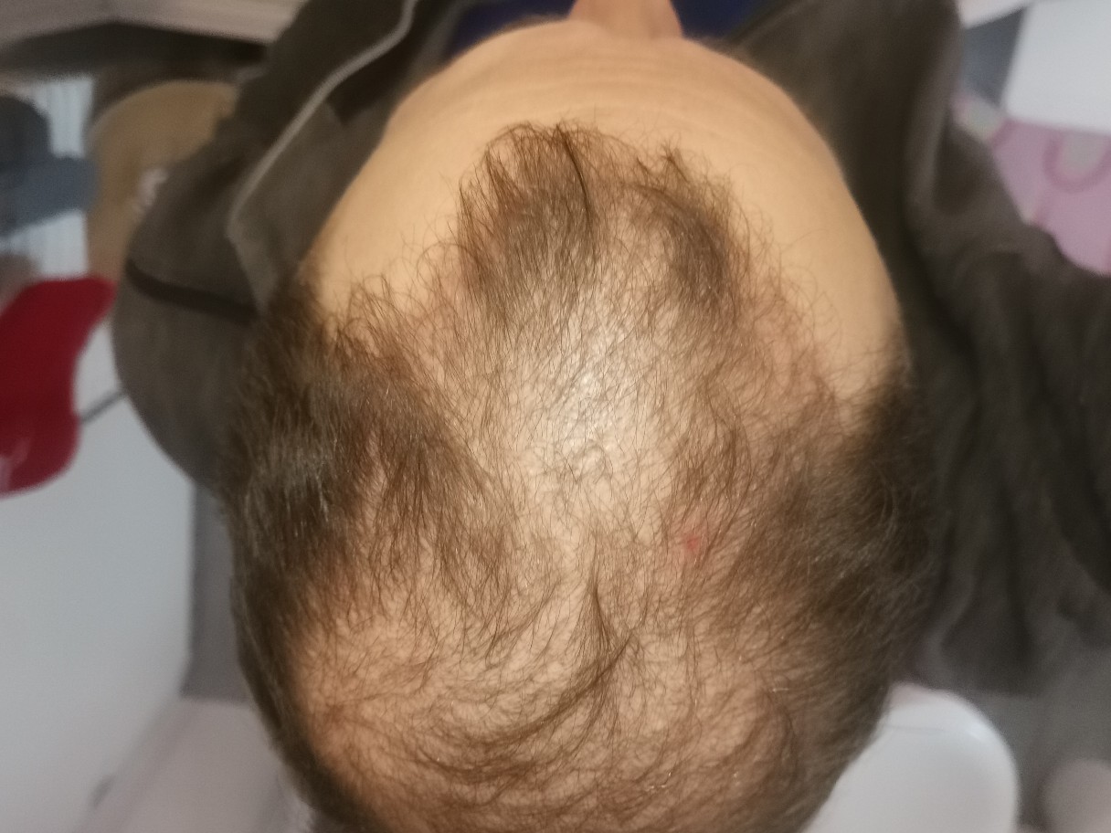 /foren/transplant/index.php/fa/50450/0/